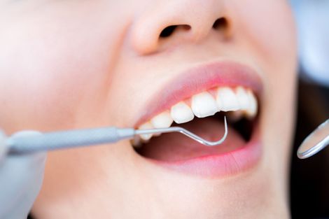 boca abierta utensilios dentista